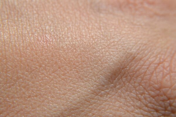 Personalized Pain Resilience: Integrating Movement, Mind, And Microbiome